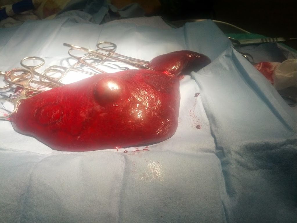 a dog with an abdominal infection after splenectomy