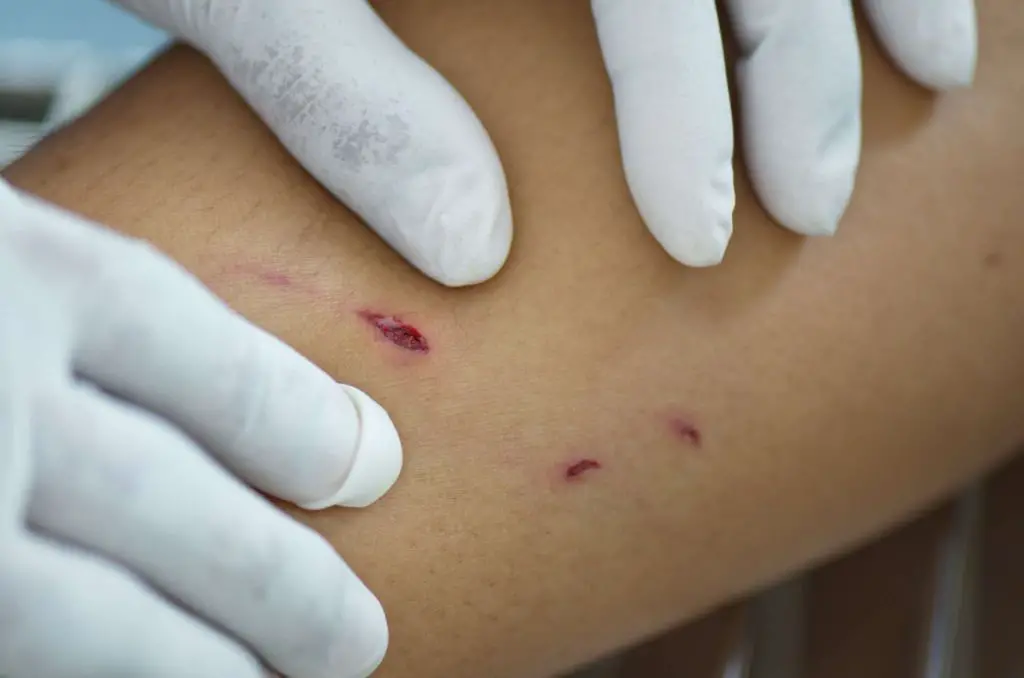 a person washing a dog bite wound