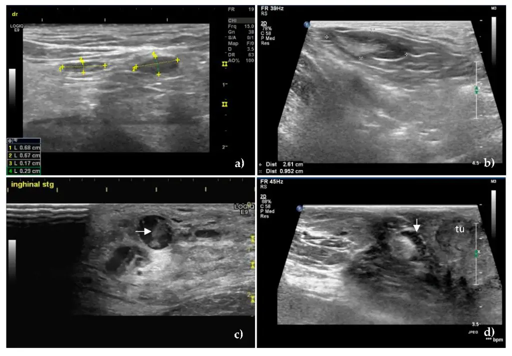 a vet performing an ultrasound scan on a dog's swollen neck area.