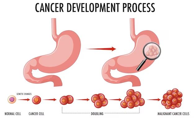 a vet showing cancer stage diagrams