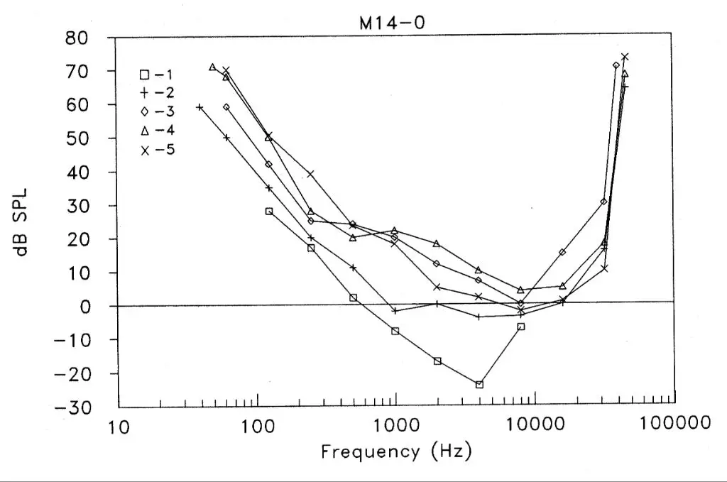 an audiogram showing hearing range by frequency and volume for each ear