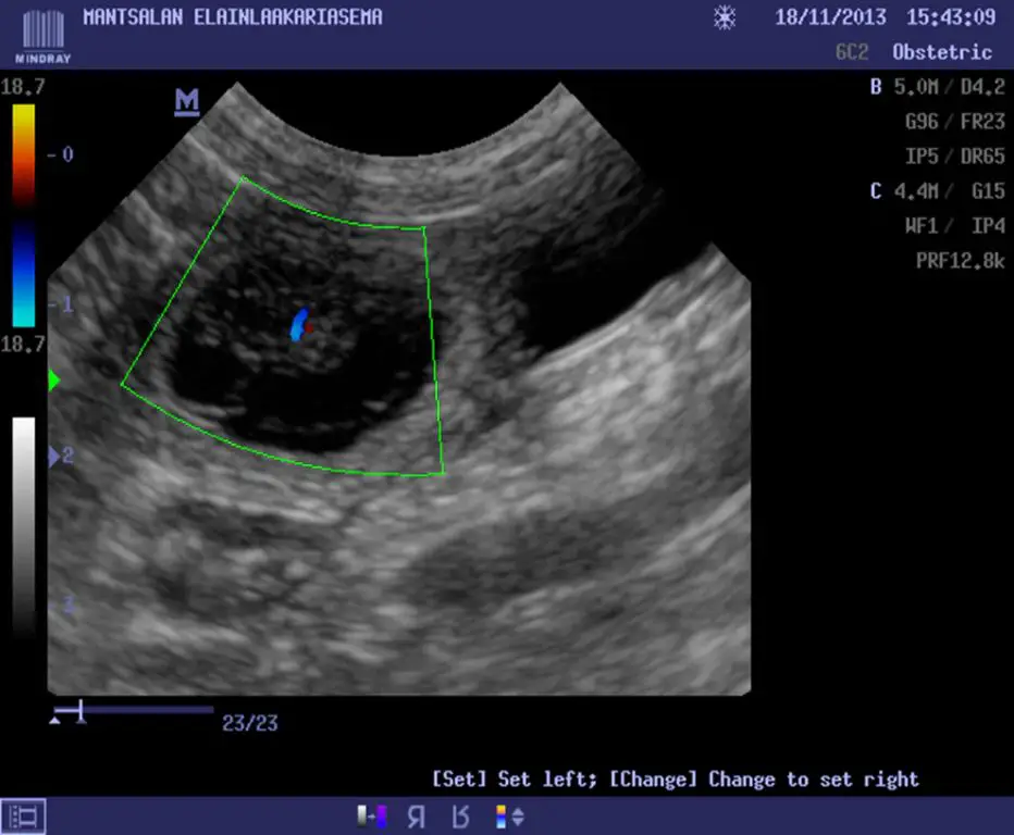 an ultrasound at 5 weeks into a dog's pregnancy shows sacs and faint heartbeats.