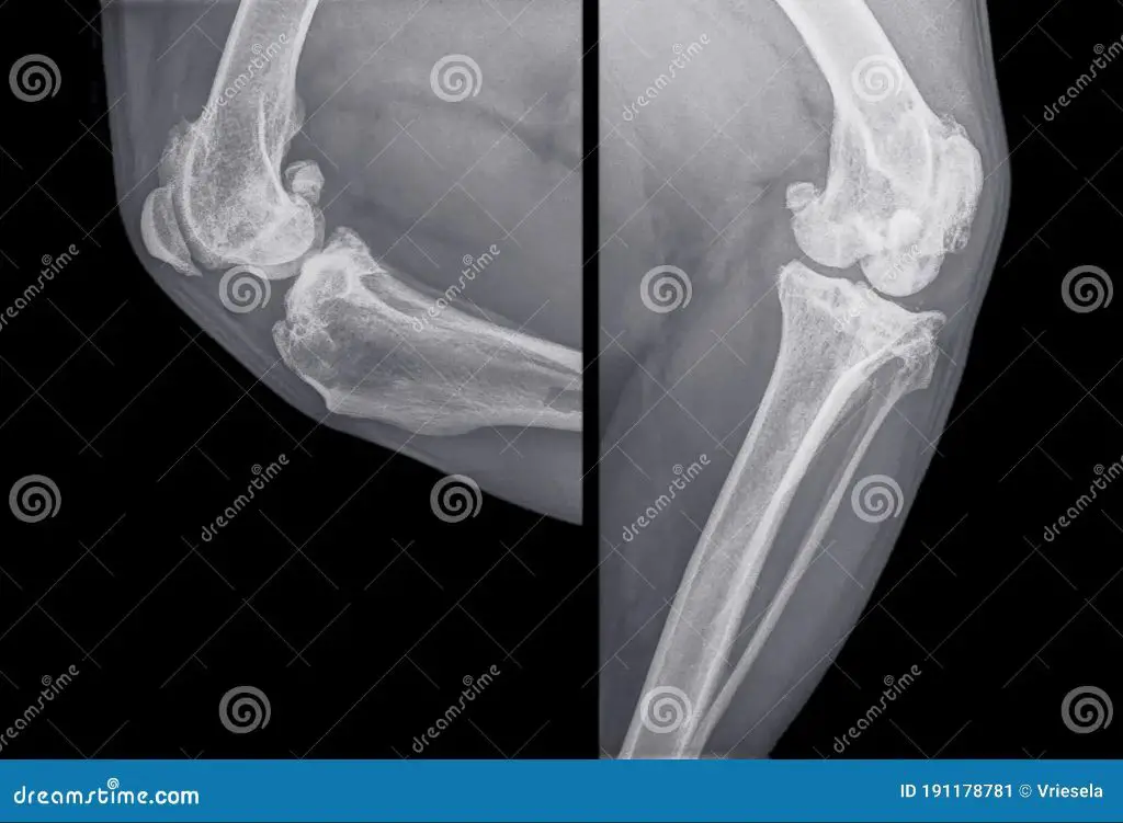 an x-ray image showing signs of arthritis in a dog's leg joints