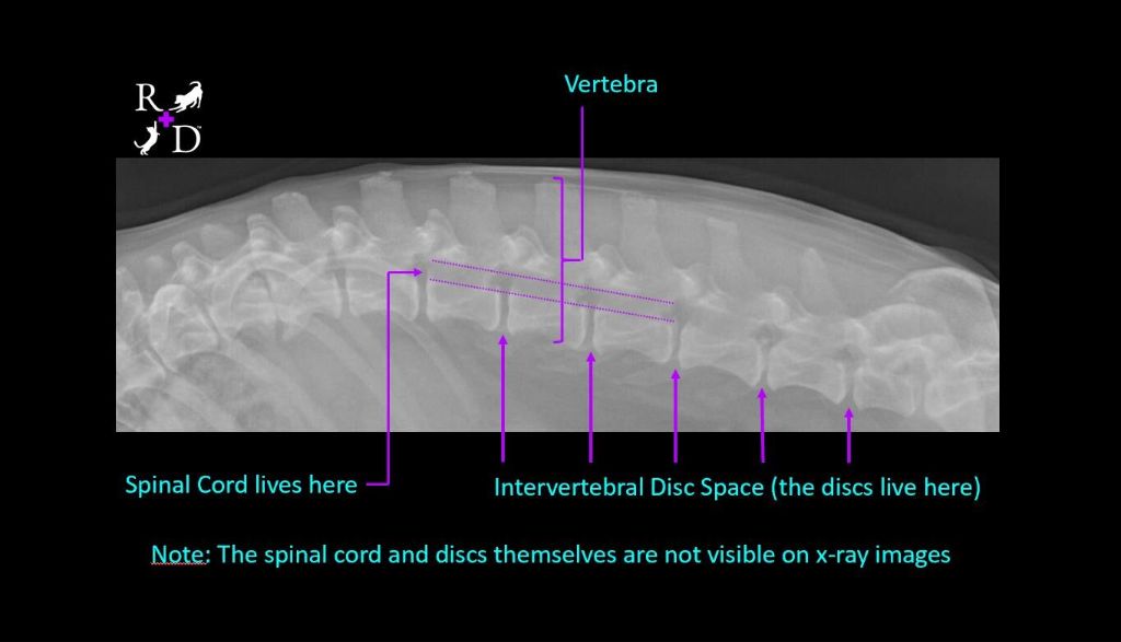 an x-ray image showing spinal anatomy