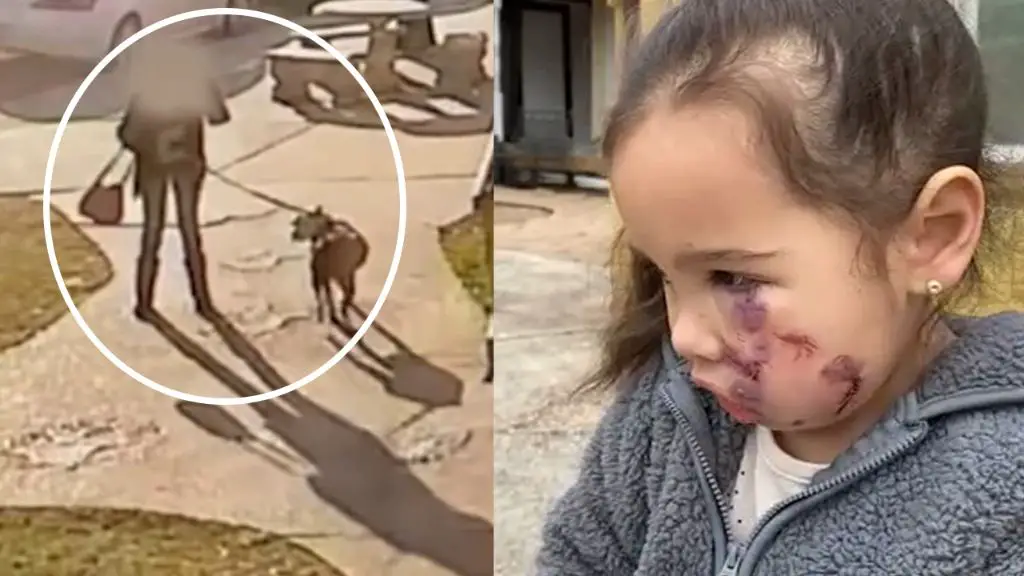 child bitten by dog receiving medical care