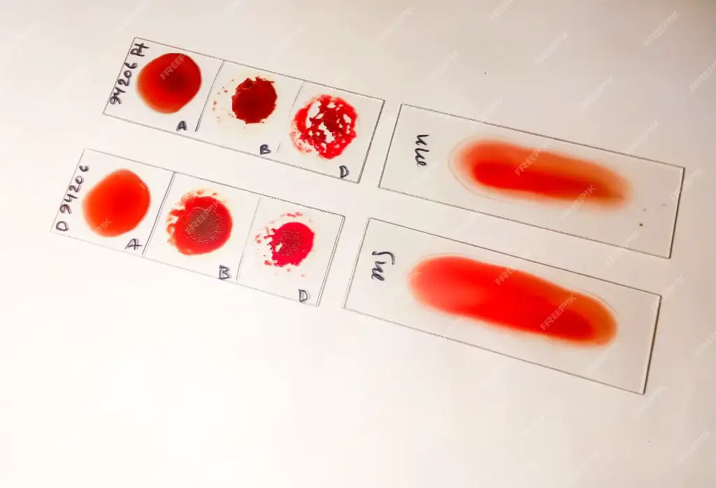 cross-matching blood prevents transfusions reactions.