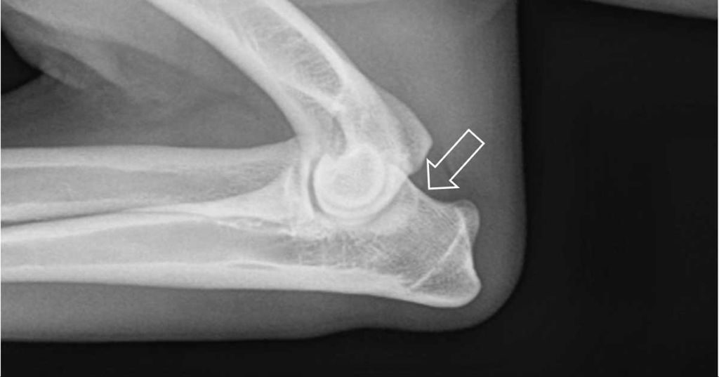 diagnosing joint problems with x-rays