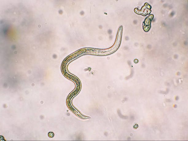 intestinal worms under microscope