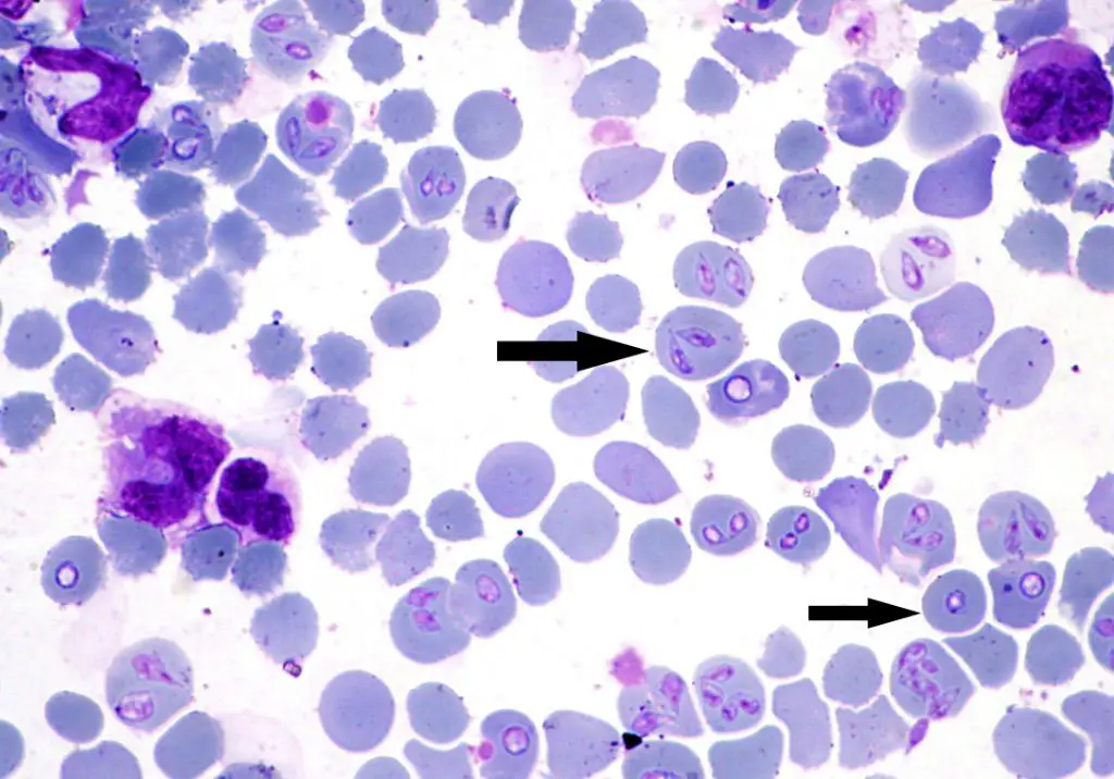 microscopic view of babesia parasites in blood