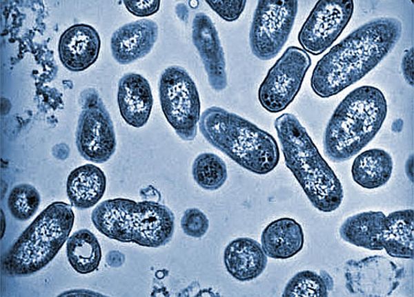 microscopic view of bacteria like salmonella