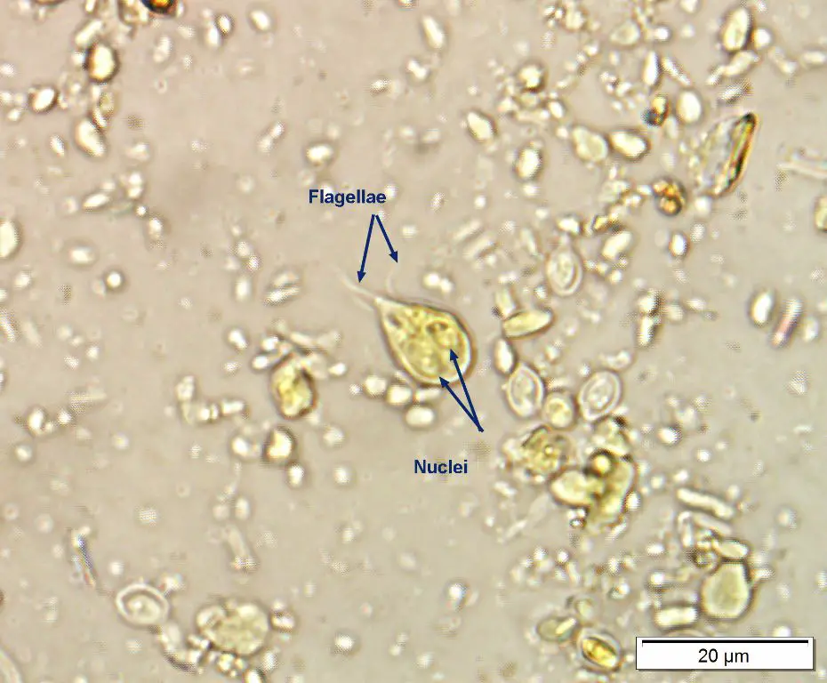 microscopic view of giardia parasites