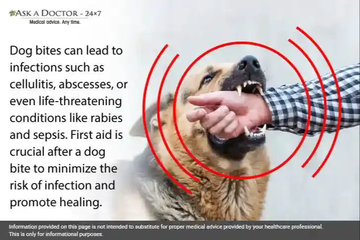 rabies is a serious risk from some animal bites.