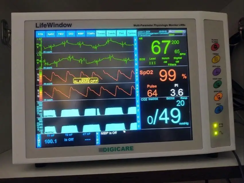 the veterinary team closely monitors the dog's vital signs throughout the dental procedure.