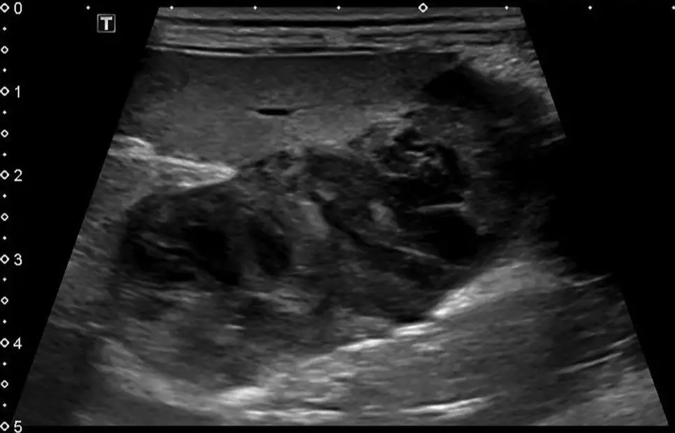 ultrasound detecting masses inside a dog's abdomen