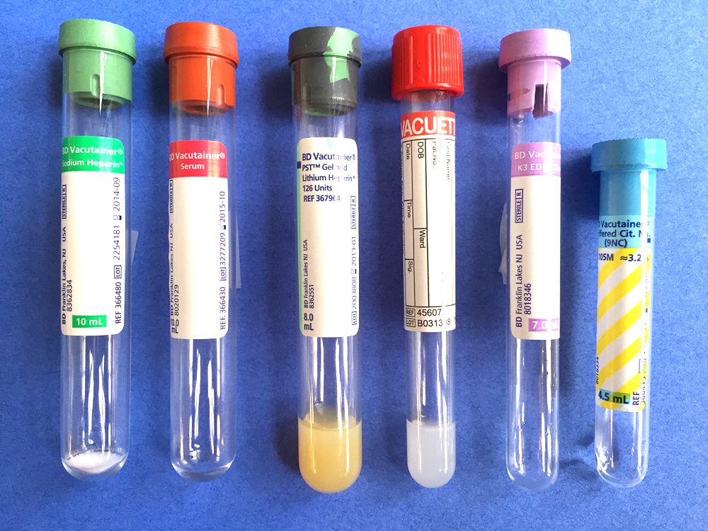 vials of blood samples for chemistry testing