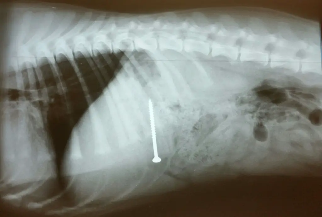 x-rays detecting blockages